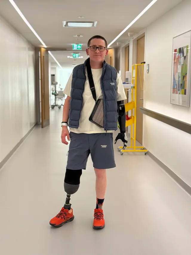 Simon standing in a hospital corridor wearing a prosthetic arm and a prosthetic leg