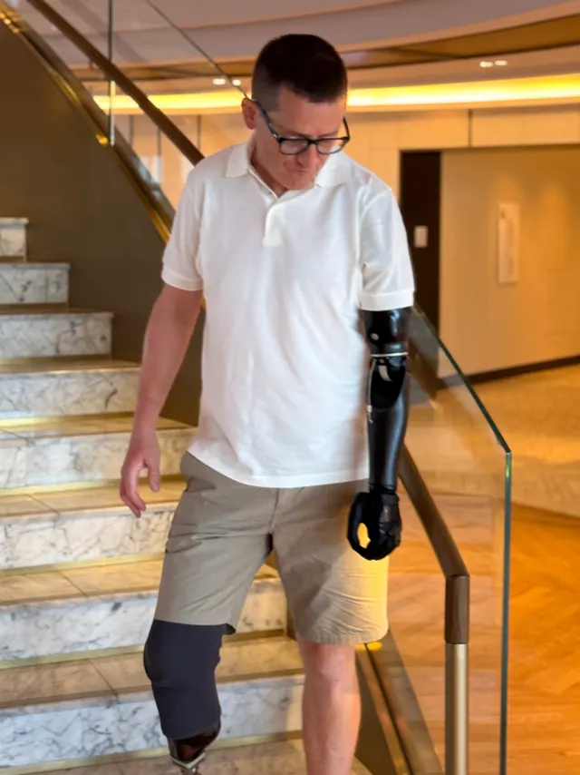 Simon walking down a staircase wearing a prosthetic arm and a prosthetic leg